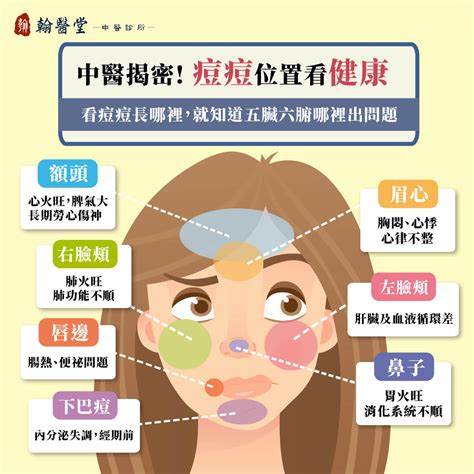 額頭長痘痘面相|額頭長痘痘怎麼辦？4個關鍵因素＋5個加分抗痘小技巧。